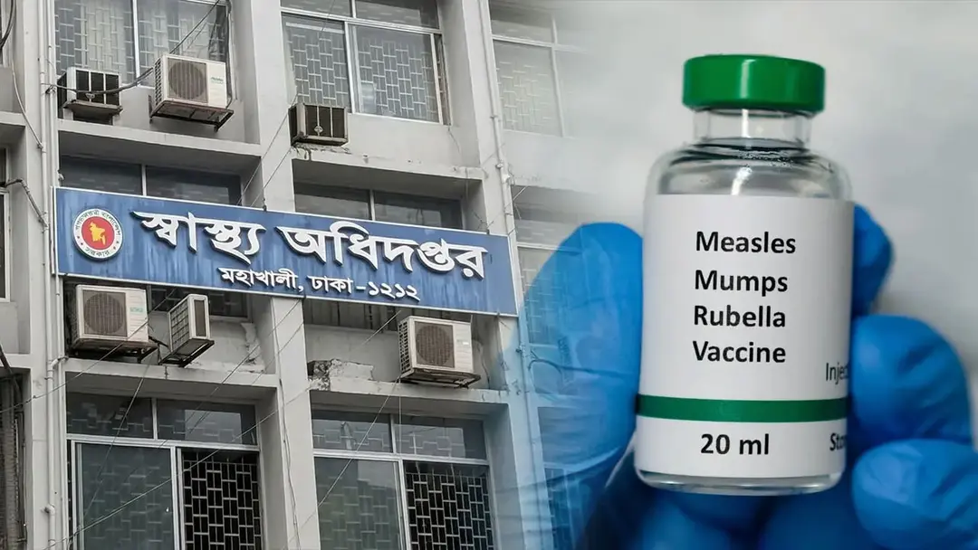 হামের উপসর্গে আরও ৫ জনের মৃত্যু, ২৪ ঘণ্টায় আক্রান্ত ১,৩৫৬